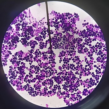 ATCC13883肺炎克雷伯菌0代菌株標準菌株